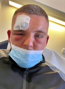 Džek Holmsa ujela konjska muva (7).png