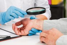 psorijaza shutterstock_1866052180.jpg