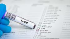 CRP test iz krvi shutterstock_2646842059.jpg