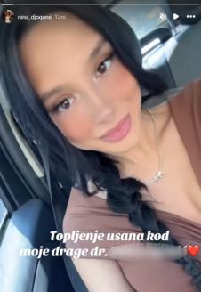 Nina Đogani pokazala proces smanjivanja usana