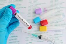 hemoglobin shutterstock_342706706.jpg
