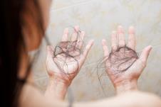 opadanje kose shutterstock_1068513638.jpg