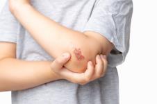 krasta povreda shutterstock_2137059679.jpg