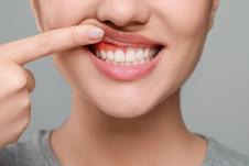 upala desni shutterstock_2399818173.jpg