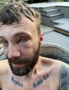 Šejn Samler tokom borbe sa kokainom