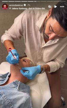 Uroš Stanić snimio proces estetskog zahvata na licu