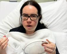 Luiza Mekdermot operacija vilice (8).png