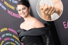 Selena Gomez lupus