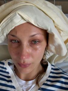 Bela Hadid ponovo u bolnici.jpg