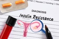 Insulinska rezistencija dijagnoza ispisana na papiru uz foto prikaz ženkog reproduktivnog sistema
