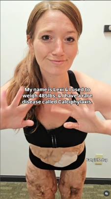 Leksi Rid nakon mršavljenja.jpg