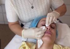 Luna Đogani na estetskoj korekciji