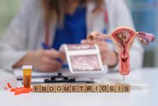 Maketa unutrašnjosti vagine sa natpisom endometrioza i lekovima