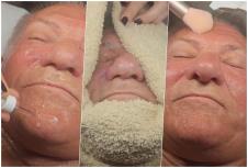 miloš bojanić  anti-ejdž tretman