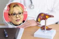prof. dr Tamara Milovanović, masna jetra