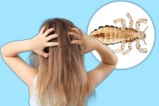 Devojčica se češe po kosi jer ima vaške