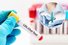 test na visok holesterol/injekcija koju drži doktor