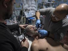 lečenje ukrajinskih vojnika