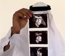 Arapin pokazuje ultrazvuk trudnice.jpg