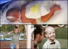 Viktor prevremeno rođena beba kolaž