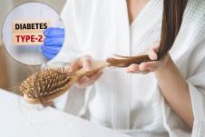 dijabetes opadanje kose