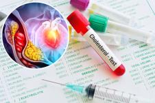 Hologramski prikaz srca i arterije zapušene holesterolom/krvni test holesterol