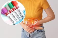 mlada žena u žutoj majici se drži za bolan stomak u predelu jetre/epruvete sa označenim krvnim grupama