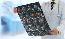 doktor u belom mantiu sa stetoskopom drži desnom rukom snimak mozga