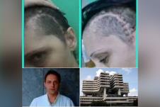 Ružica moždani udar