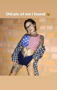 Meri Magdalena pre operacija