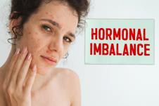 devojka na licu ima akne izazvane hormonskim disbalansom/natpis hormonski disbalans
