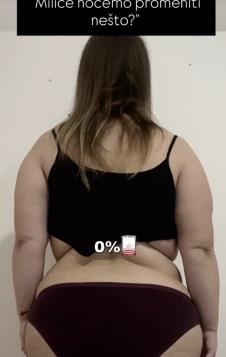 Milica Đukanović pre gubitka kilograma (6).png