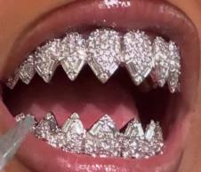 Nort Vest ugradila dijamanstke zube