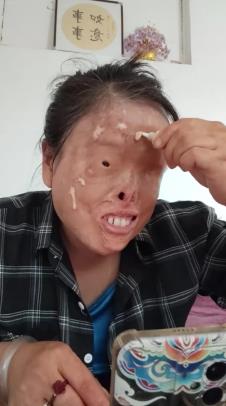 Žena crta kompletno lice jer ju je muž polio kiselinom