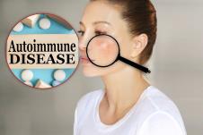 mlada žena sa promenama na koži lica uvećanim lupom, koncept lupus/autoimune bolesti