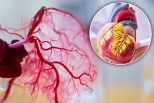 sistem krvnih sudova/model srca