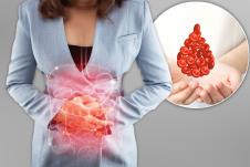 žena se drži za stomak u predelu creva koja su grafički prikazana/iznad ruku crvena krvna zrnca u ubliku kapi krvi