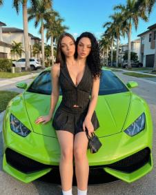 Sijamske bliznakinje Valerija i Kamila iz Majamija