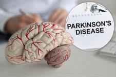 parkinosnova bolest/mozak