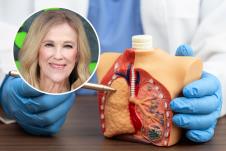 Ketrin O’Hara/doktor pokazuje na model pluća