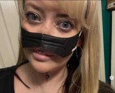 Lin Ebejans - otišla u Tursku da uradi zube, vratila se sa infekcijom