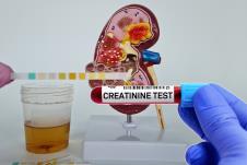 kreatinin, analiza, bubrezi