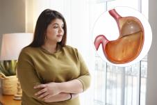 gojaznost, balon za mršavljenje lek za mršavljenje