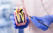 Stomatolog sa plavim rukavicama drži poprečni presek modela zuba i metalnim instrumentom pokazuje upaljeni koren i unutrašnju strukturu zuba