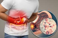rak želuca/muškarac koji se drži za stomak, prikaz želuca i creva