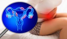 bol u stomaku/Ilustracija endometrioze