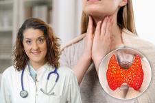 operacija štitaste žlezde i gomilanje kilograma/dr Olga Ličina