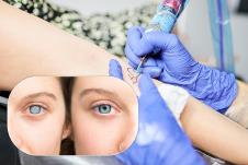 TETOVIRANJE GUBITAK VIDA