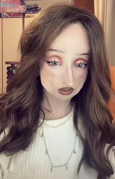 Anja Korčagina, devojka čiji je život obeležen progerijom