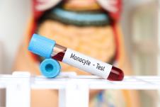 epruveta sa uzorkom krvi za analizu monocita